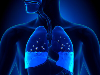 Disease-associated gut microbiome and metabolome changes in patients with chronic obstructive pulmonary disease